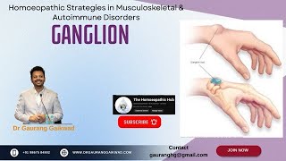 Homoeopathic Strategies in Ganglion Dr Gaurang Gaikwad [upl. by Corilla]