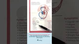 Understanding Left vs Right Heart Failure for Nursing Students 🌟 [upl. by Lisabet]