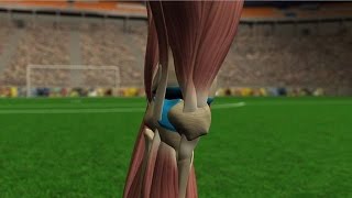 Lesiones de rodilla [upl. by Alilad]