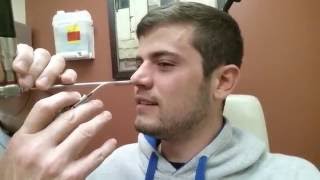 Septoplasty  Nasal Splint Removal  Post Surgery [upl. by Sito]