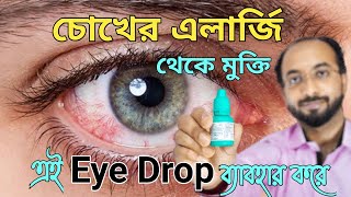 Eye Allergy Drops  Eye drop for allergy  চোখের এলার্জি দূর করার উপায়  চোখdrarifurrahman [upl. by Cattan866]