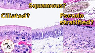 Surface Epithelium  Identifying Different Types [upl. by Schiff]