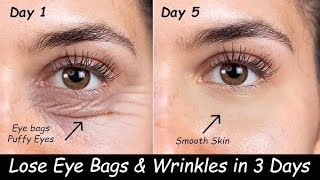 Remove Under Eye Wrinkles  Puffy Eyes amp Dark Circles amp Under eye cream for dark circles ampWrinkle [upl. by Haynor762]