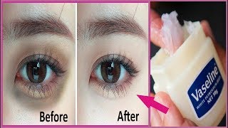 Vaseline सिर्फ 1 बार में आंखों के काले घेरे Dark Circlesको गायब कर देगा  DARK CIRCLES REMOVE [upl. by Breban]