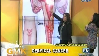 Understanding Cervical Cancer [upl. by Waverley948]