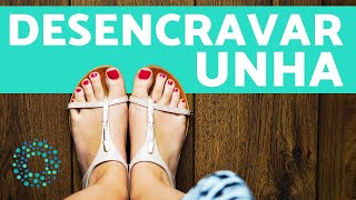 COMO DESENCRAVAR UNHA  remédios para unha encravada [upl. by Evangelist]