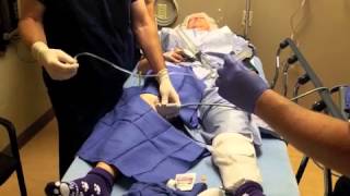 Makoplasty and ACL Reconstruction  Saphenous Nerve Block for Outpatient Knee Surgery [upl. by Pritchard]