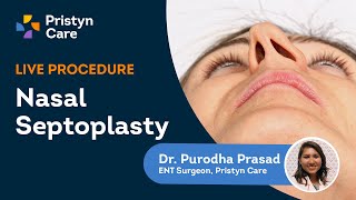 Deviated Septum Surgery  Endoscopic Septoplasty Explained  Pristyn Care [upl. by Lougheed]