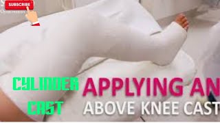 How to apply an cylinder cast Above Knee Cast pop [upl. by Romilda72]