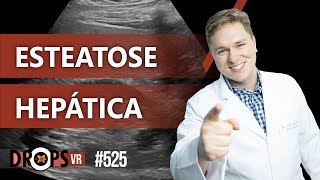 COMO AVALIAR ESTEATOSE HEPÁTICA NO ULTRASSOM  VOCÊ RADIOLOGISTA [upl. by Yerd999]