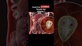 Giardia Infection is often mistaken for IBS Symptoms guthealth shorts youtubeshorts [upl. by Goulder10]