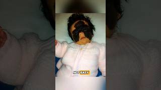 Unbelievable Babys Black Birthmark Stuns Doctors MedicalMystery Newborn Markyoutubeshorts [upl. by Erasme]