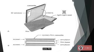 Radiofotografi  Intensifying Screen IS [upl. by Sollows]