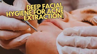 Deep Facial Extraction For Clear Skin  Blackheads Milia and Acne Treatment [upl. by Gianni]