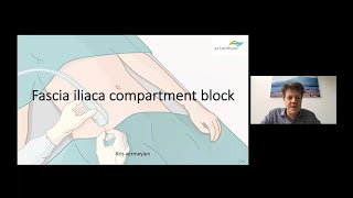 Suprainguinal Fascia Iliaca Block for Perioperative Analgesia after Total Hip Arthroplasty [upl. by Walton]