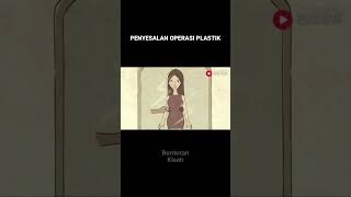 Jangan operasi plastik sebelum nonton ini animasi shortvideo shortmovie plasticsurgery [upl. by Annatnas]