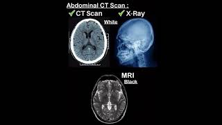 CT Scan Abdomen learning shorts 01  How to read Ct abdomen  mri vs ct abdomen and pelvis anatomy [upl. by Aiasi]