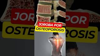 Síntomas Ocultos de OSTEOPOROSIS 😱 [upl. by Cichocki]