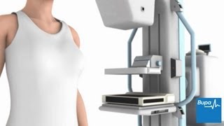 How a mammogram is carried out  Bupa Health [upl. by Combs]