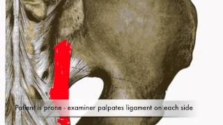 Provocation of Long Dorsal Sacroiliac Ligament Test CR [upl. by Alleuol62]