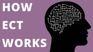 How ECT Works electroconvulsive therapy [upl. by Anelhtak639]