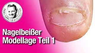 Nagelbeißer im Nagelstudio behandeln TEIL1 [upl. by Cj]