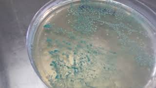 Candida albican on candida deferential agar plate  Budding yeast [upl. by Aicilev]