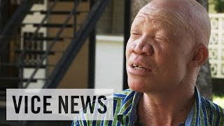 Albino Activism in Tanzania VICE News Meets Josephat Torner [upl. by Ennalyrehc254]