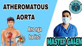 Ano ang Atheromatous Aorta [upl. by Montgomery]