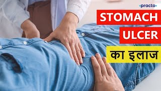 Treatment of Peptic Ulcer  Stomach Ulcer Remedies in Hindi  Practo [upl. by Soni854]