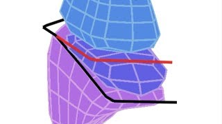 Lung Lobes amp Fissures  Simple 3D Anatomy [upl. by Miyasawa342]