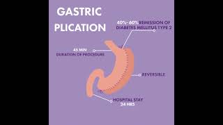 Gastric Plication at VIDA WELLNESS AND BEAUTY [upl. by Herta]