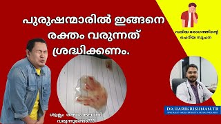 പുരുഷന്മാരിൽ ഇതുപോലെ രക്തം വരുന്നത് ക്യാൻസർ സൂചനയാകാം Blood in semen DrHarikrishnanTR [upl. by Negriv]