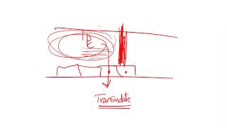 286 Acute Inflammation  Macrophages rule amp Exudate vs Transudate [upl. by Eicnarf349]