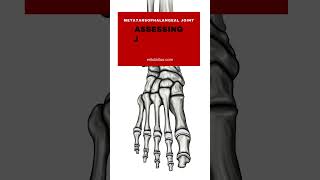 Assessing Joint Play Restrictions in the Metatarsophalangeal Joint  ErikDaltoncom [upl. by Notniv]