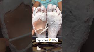 Repair Cracked Heels In 1Day  Get Rid Of Dry Feet  Get Fair amp Soft Feet Instantly cracked shorts [upl. by Vachel]