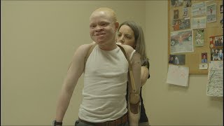 Tanzanian albino children get new limbs in US [upl. by Terese]