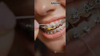 How Toothpick can harm your teeths and gums  shorts ytshorts ytshortsindia viralvideos [upl. by Honebein]