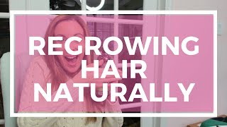 Regrowing Hair How To Regrow Lost Hair Naturally [upl. by Ggerc843]