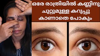 OVERNIGHT Dark Circles Remedy  ഒരു രാത്രി കൊണ്ട് തന്നെ മാറ്റം കാണാം  Undereye Massage [upl. by Aicilas]