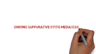 CHRONIC SUPPURATIVE OTITIS MEDIA CSOM   lecture  NEET PG  NOTES [upl. by Manchester]