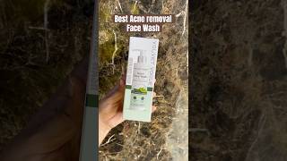 Best acne removal face wash acneproneskin oilyskin [upl. by Seidler356]