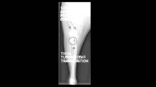 Medial Patellar Luxation explained by Dr Bauer [upl. by Ttehr]