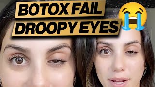 Botox Gone Wrong Droopy Eye  Cheap Fix [upl. by Sej]