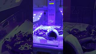 Phototherapy treatment for jaundicePhotography in newborn🏥shortsshortsfeedshortvideonicucare [upl. by Kleeman]