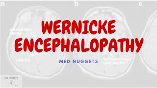 Wernicke Encephalopathy causes symptoms diagnosis prevention and treatment  MED nuggets [upl. by Clair]