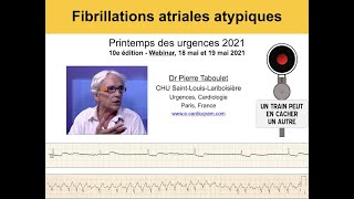 5h Fibrillations atriales très atypiques ECG Dr Taboulet [upl. by Ema506]