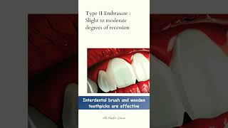 Achieve Better Oral Health with Interdental Cleaning Aids👨‍🔬✅🦷 shorts floss dental [upl. by Adelice606]