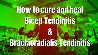 Bicep tendonitis amp brachioradialisforearm tendinitis [upl. by Chaille]