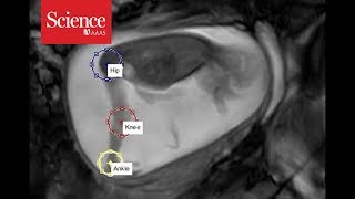 Snippet Tracking fetal movements at 24 weeks [upl. by Nyltac106]